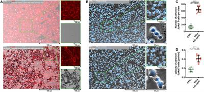 CRISPR-Based Activation of Endogenous Expression of TPM1 Inhibits Inflammatory Response of Primary Human Coronary Artery Endothelial and Smooth Muscle Cells Induced by Recombinant Human Tumor Necrosis Factor α